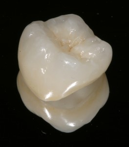corona protesica