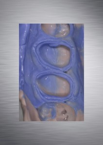 impronta in silicone_particolare